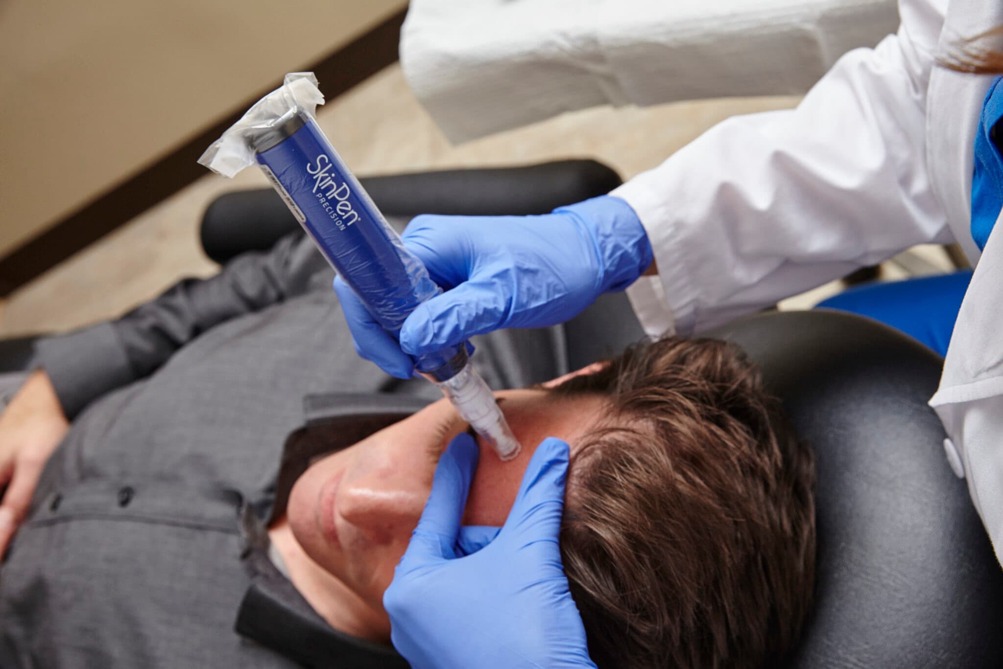 Microneedling treatment 3